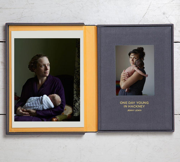 Collector's Edition + Print: One Day Young In Hackney